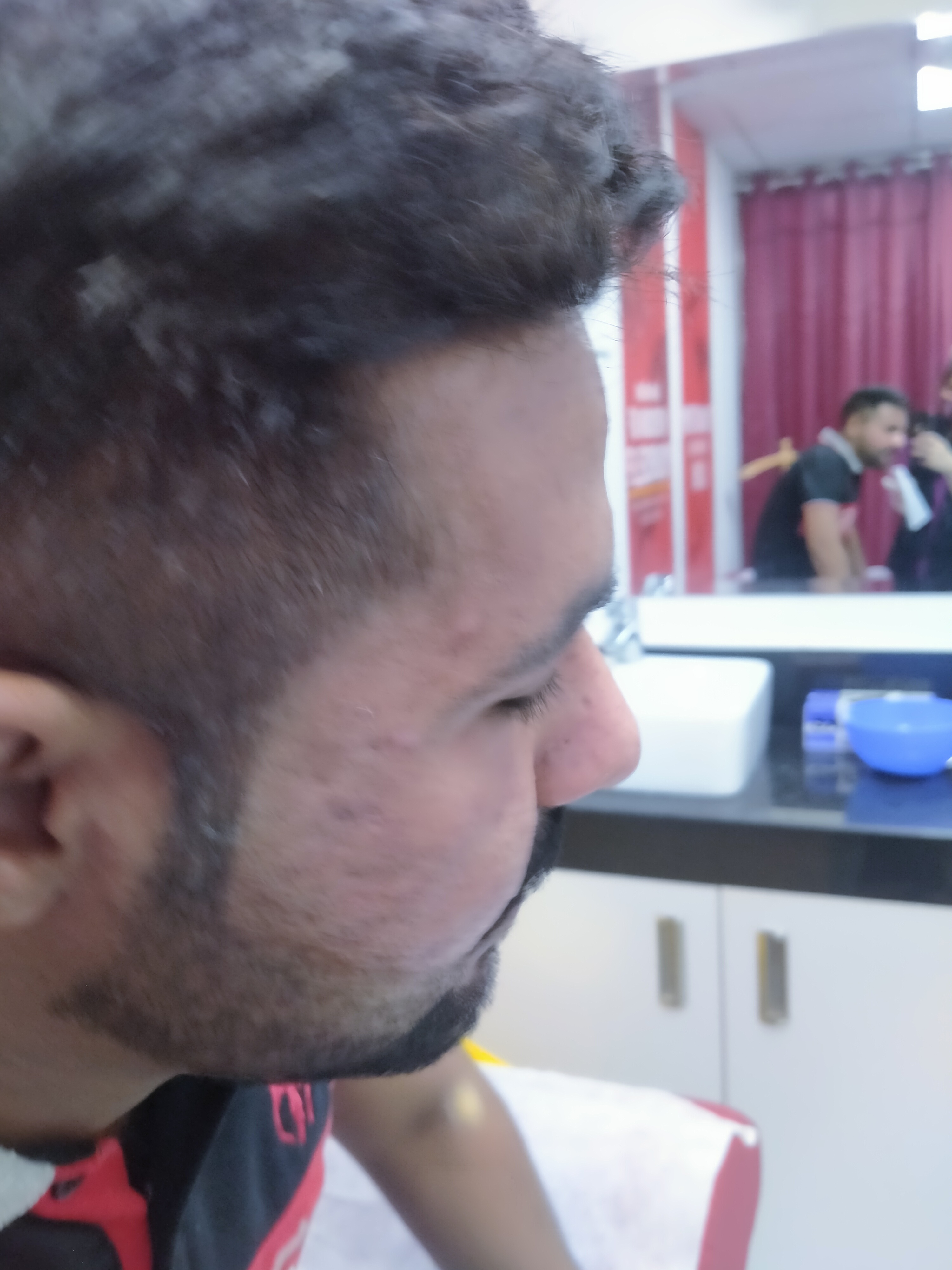 Skin treatment for acne scars