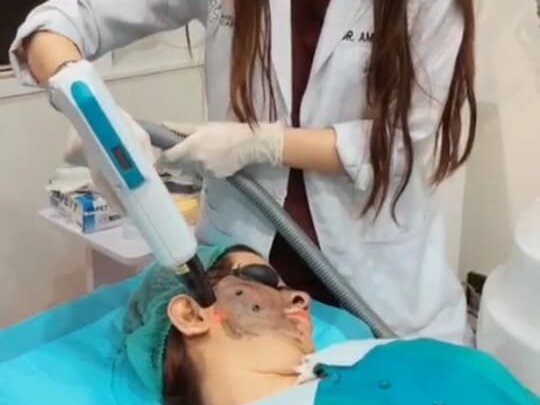 Carbon Laser by Dr. Amna Nasir image 1