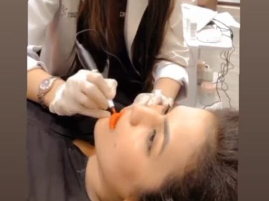 Chemical Peel by Dr. Amna Nasir image 1