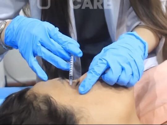 Filler (Under Eye) by Dr. Amna Nasir image 1