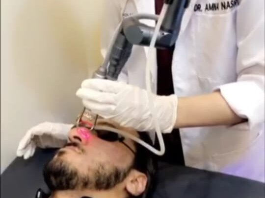 CO2 Laser For Skin Rejuvenation by Dr. Amna Nasir image 1