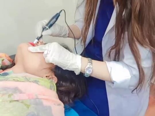 Hydra Facial - Glow by Dr. Amna Nasir image 1