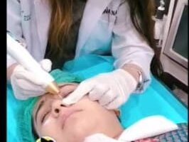 Hydra Facial - Holistic Signature by Dr. Amna Nasir image 1