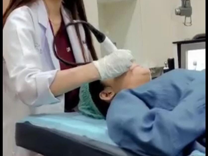 Laser Hair Removal - Full Face by Dr. Amna Nasir image 1