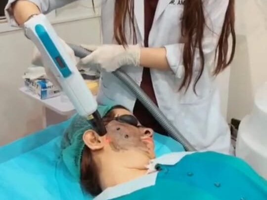 Meso + PRP - Face by Dr. Amna Nasir image 1