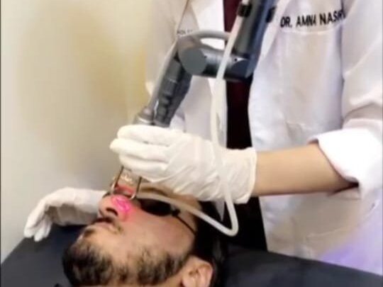 Mole Removal (Per Mole) by Dr. Amna Nasir image 1