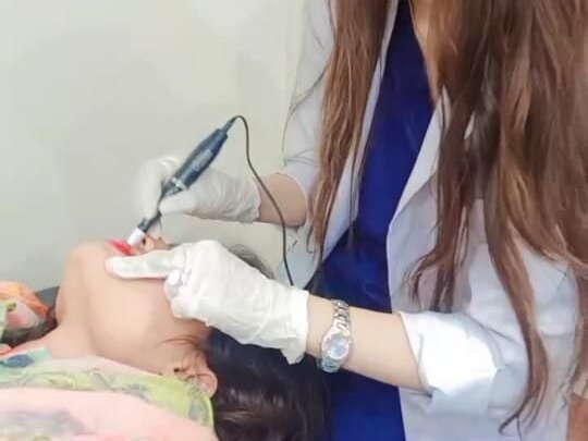 Permanent Lip Color by Dr. Amna Nasir image 1