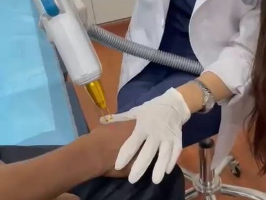 Tattoo Removal by Dr. Amna Nasir image 1