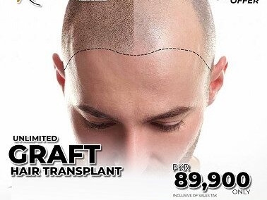 Hair Transplant (Graft) by  American Aesthetics image 2