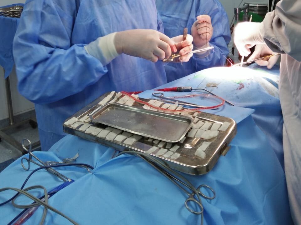 Discectomy by Dr. Muhammad Yasir Mukhtar image 1