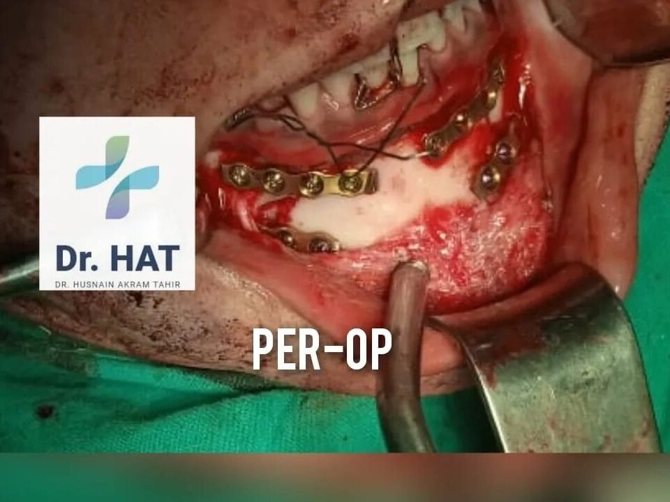 Child Patient Dental Rehab by Dr. Husnain Akram Tahir image 1