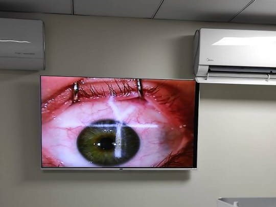 Cataract Eye Surgery (Phaco) by Dr. Tariq Mahmood image 1