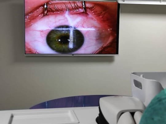 DCR With Intubation by Dr. Tariq Mahmood image 1