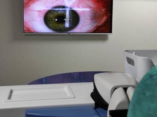 Glaucoma Dramamine Surgery (Trabeculectomy) by Dr. Tariq Mahmood image 1