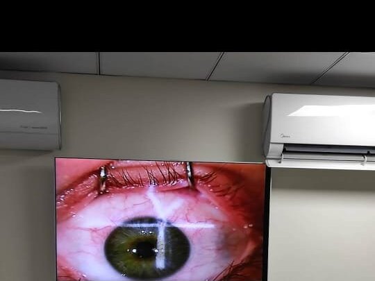 Chalazion 1/C (One Eye) by Dr. Tariq Mahmood image 1