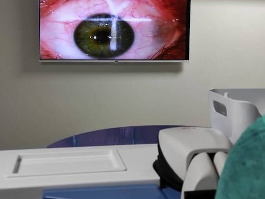 Corneal FB Removal by Dr. Tariq Mahmood image 1