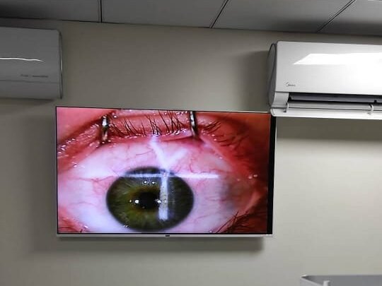 Cataract Eye Surgery by Assist. Prof. Dr. Adeel Randhawa image 1