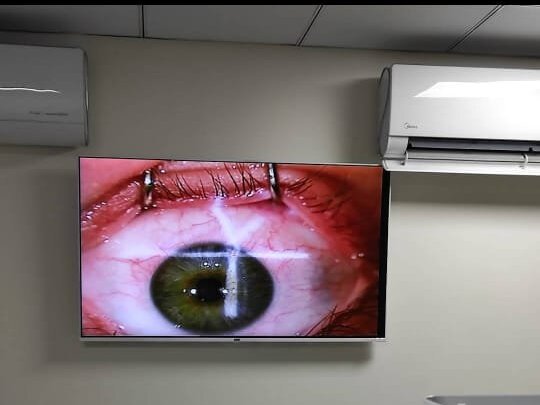 LASIK (Femto) by Assist. Prof. Dr. Adeel Randhawa image 1