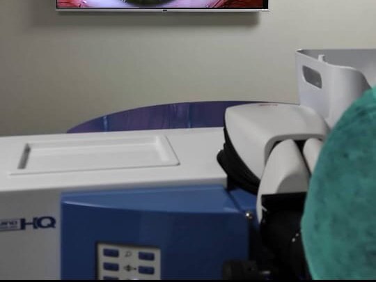 Histectomy by Prof. Dr. Ghazala Bashir image 1